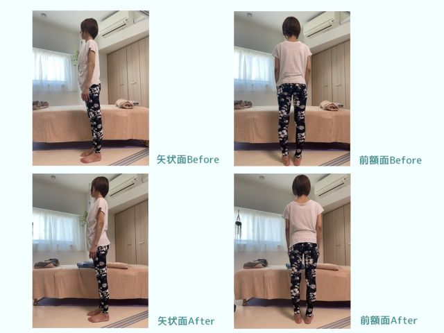 ☻︎
こんにちは、ヨガトハリです
.
”ある日の鍼灸メンテナンス”
せいこ先生のご厚意に甘え
お写真を交えて治療の流れについて
HPに投稿しました
（プロフのリンクから読めます）
.
.
感じてほしいのは
見た目でなく内側で起こる変化
写真では伝わらない感覚を
「感動に似た安堵」なんて表現してみました
.
映えのための治療は一切しないので
キラキラ写真は今後も載せないかも。。
.
そんな頑固一徹なサロンですが、
ヨガトハリの鍼、ぜひお試しください
.
@feeling_yoga_yakuzen 
@yogatohari_24 
.
.
#治療風景 
#こんな感じでやってます 
#ビフォーアフター 
#姿勢改善 
#せいこさんありがとう 
.